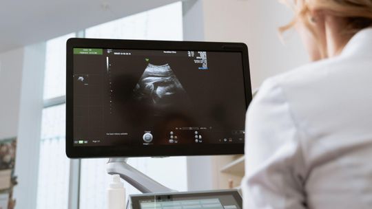 Endokrynolog ginekolog Warszawa – kompleksowa diagnostyka i leczenie zaburzeń hormonalnych u kobiet
